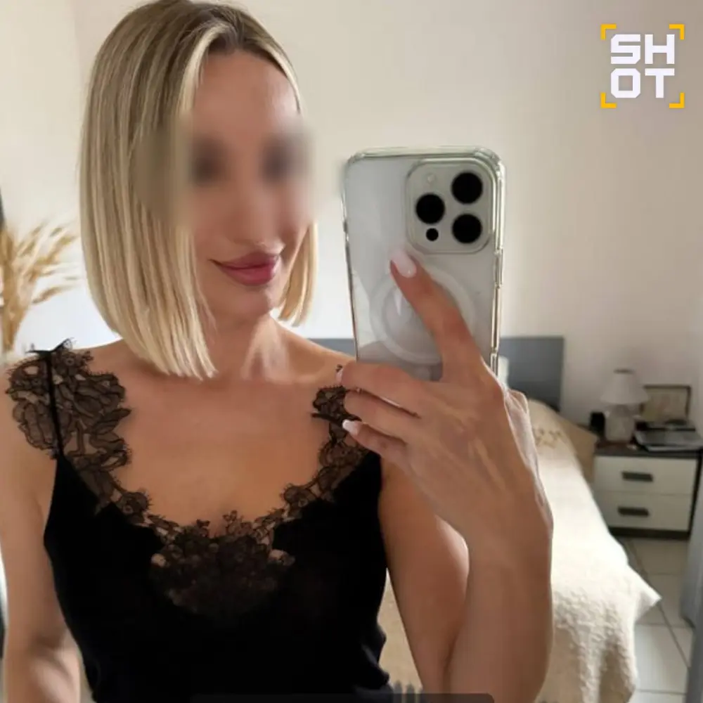 Bloqer plastik əməliyyatdan sonra öldü - Foto