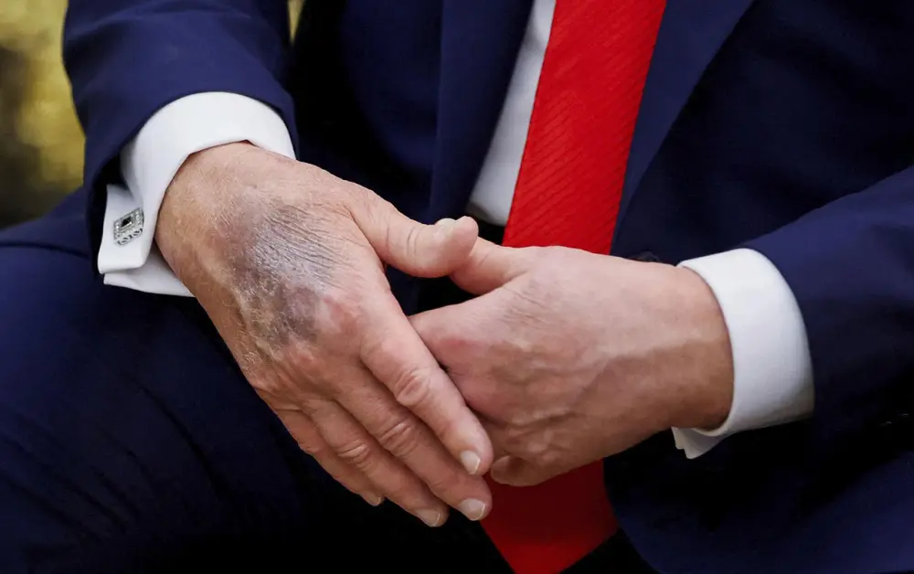 Yenə əlləri ilə gündəm oldu – Foto