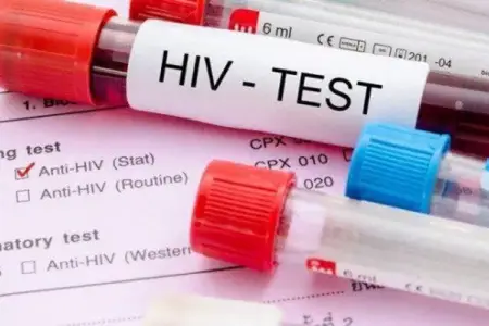 Azərbaycanda İİV-ə yoluxanların sayı açıqlandı