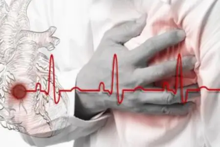 Üç sadə həyat tərzi dəyişikliyi insult riskini azaldır