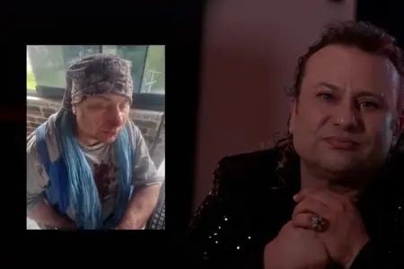 Məşhur sənətçi pitbull hücumuna məruz qaldı, üzünə tikiş qoyuldu 