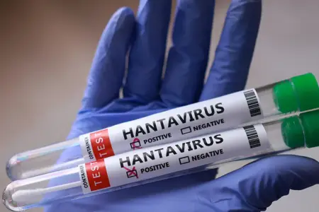 Daha bir ölkədə hantavirusa yoluxma qeydə alındı