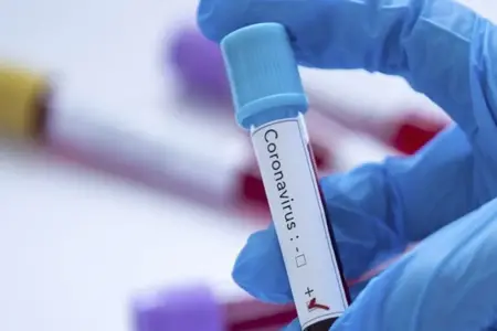 Yarasalarda yeni koronavirus növü aşkarlandı