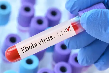 Ebola virusundan ölənlərin sayı artd