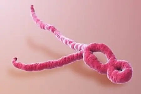 Konqoda "Ebola" virusuna yoluxanların sayı 676-ya çatdı