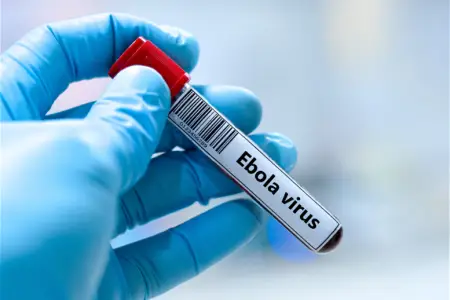 Ebola Avropaya yayıldı: Fransada ilk yoluxma...
