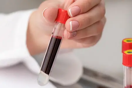 Diabet riski yüksək olan qan qrupu açıqlandı