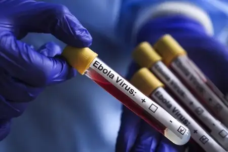 ÜST: Konqoda Ebola qurbanlarının sayı 967-yə çatıb      