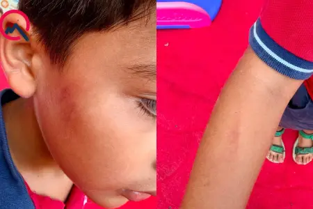 Azyaşlı bağçada döyülüb? - Foto-Video