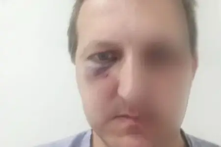 Xalq artistinin oğlunun döyülməsinə görə daha 2 şəxs saxlanıldı