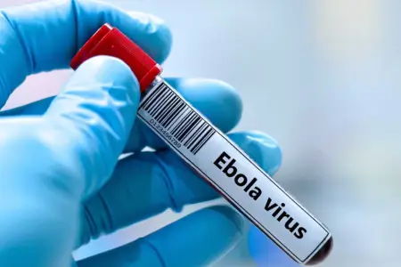 Ebola virusu ilə bağlı həyəcan təbili - Sürətlə yayılır