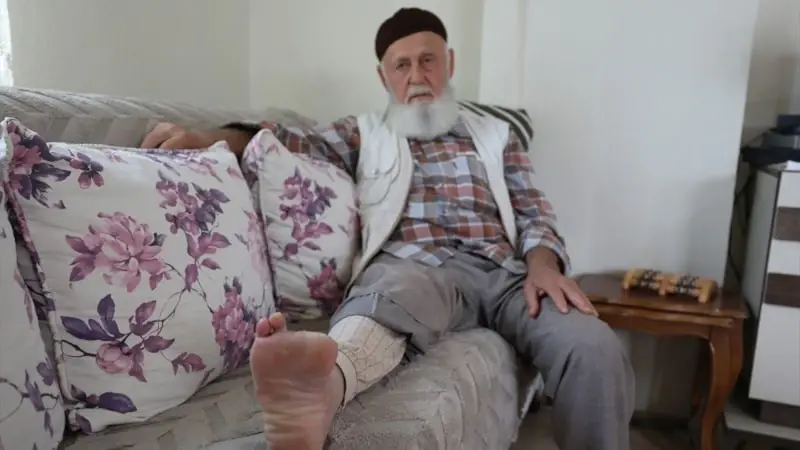 Siqaretə görə 3 barmağını itirdi - FOTO