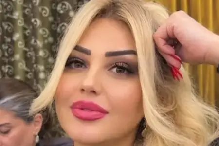 Bakıda qadın dişini çəkdirdiyinə görə vəfat edib? - Video