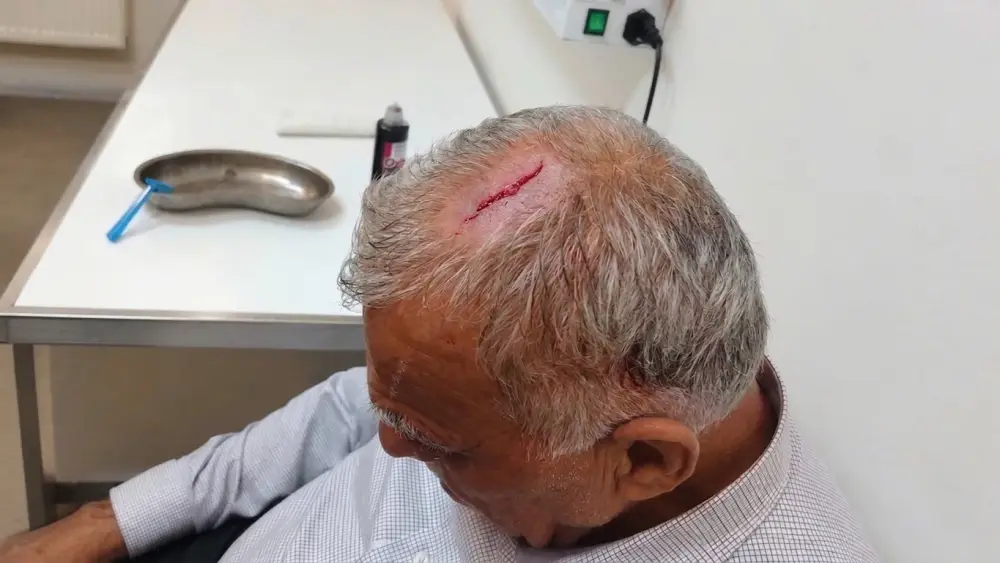 İcra nümayəndəsi bələdiyyə sədrinin başına butulka çırpdı