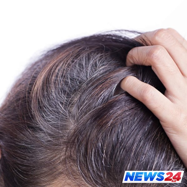 Nəyə görə stressdən saçlar ağarır – Əsas səbəb 
