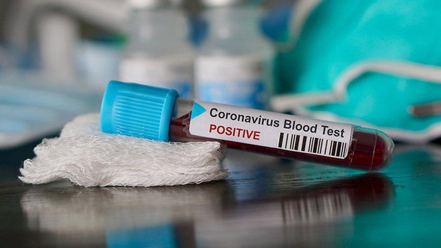 Gürcüstanda koronavirusa yoluxanların sayı 83 nəfərə çatdı 