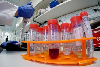 Azərbaycanda koronavirusa görə 25 mindən artıq test edilib 