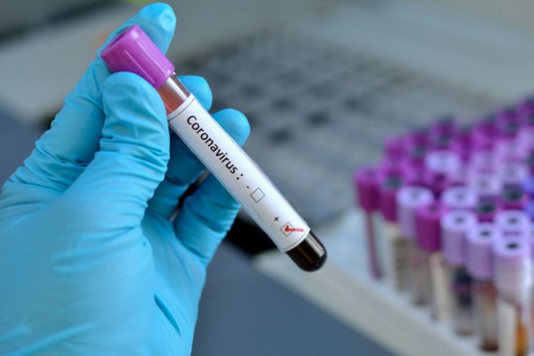 Naxçıvanda 71 nəfərdə koronavirus aşkarlandı -  1 NƏFƏR ÖLÜB