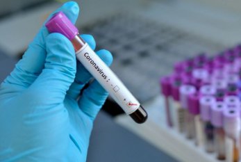 Azərbaycanda 4078 koronavirus testi HƏYATA KEÇİRİLİB