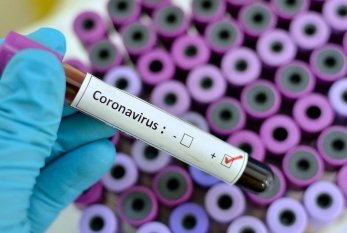 Azərbaycanda 1717 nəfər koronavirusa yoluxub, 1221-i sağalıb, 22 nəfəri ölüb