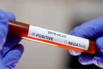 Azərbaycanda koronavirusa görə 143079 test aparılıb - RƏSMİ