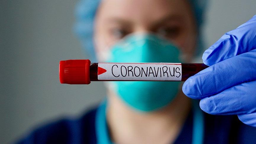 Daha 101 nəfərdə koronavirus aşkarlandı - 1 NƏFƏR ÖLDÜ