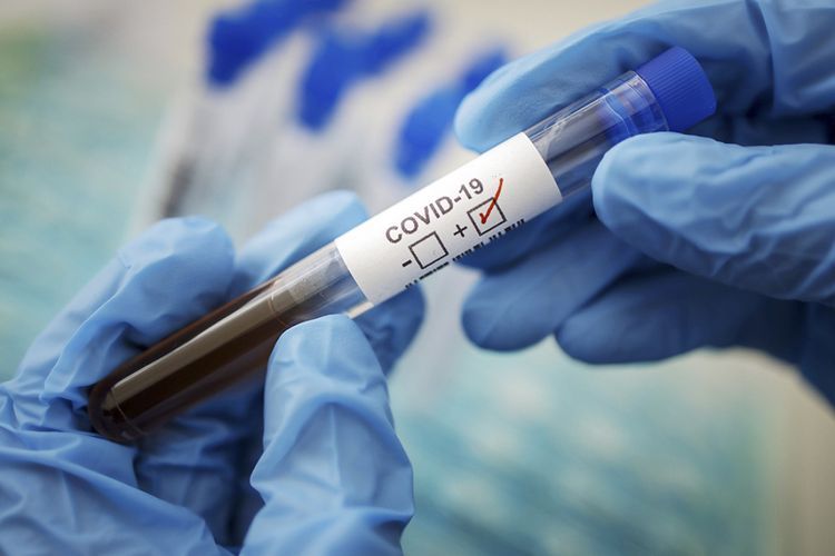 Daha 131 nəfərdə koronavirus aşkarlandı - 1 NƏFƏR ÖLDÜ