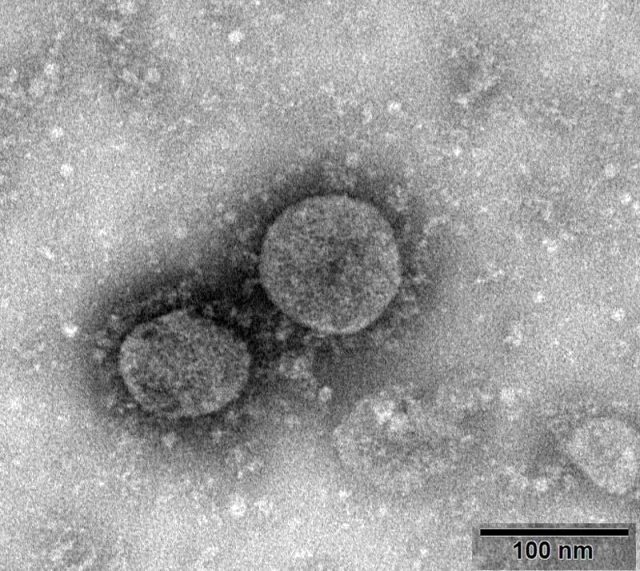 ABŞ-da yeni ölümcül virus YAYILMAĞA BAŞLADI - VİDEO