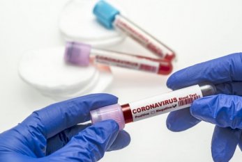 Azərbaycanda daha 67 nəfər koronavirusa yoluxub, 2 nəfər VƏFAT EDİB