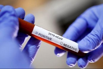 İranda koronavirusla bağlı yeni test HAZIRLANDI