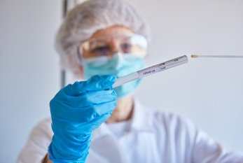 Fransada koronavirusdan ölənlərin sayı 28 MİNİ ÖTDÜ