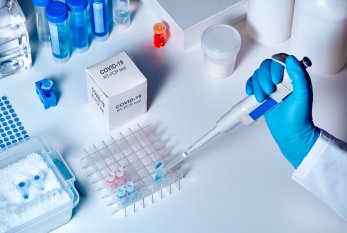 Özəl klinikalarda koronavirus testinin qiyməti AÇIQLANDI
