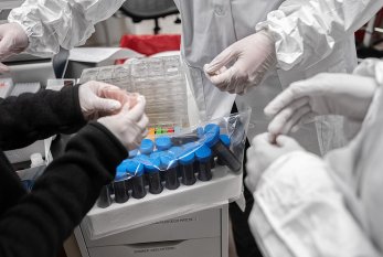 Azərbayccanda 526 nəfər koronavirusa yoluxdu - 8 nəfər vəfat etdi