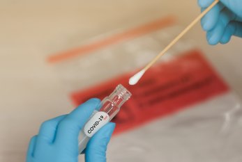 Azərbaycanda aparılmış koronavirus testlərinin sayı 700 mini keçib 