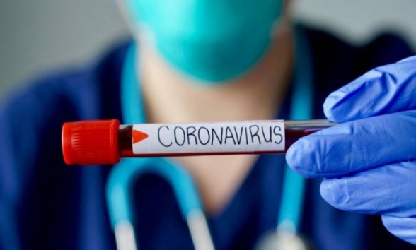 Məşhur müğənni koronavirusa YOLUXDU