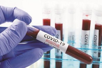 Özəl klinikalarda koronavirus testinin qiyməti necə müəyyən olunur? 