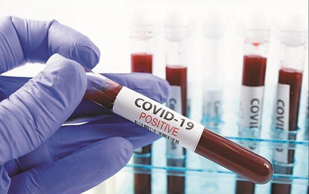 Sutka ərzində koronavirusa yoluxanların sayı 370-ə çatdı