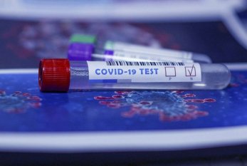 Azərbaycanda indiyədək 1187136 koronavirus testi aparılıb 