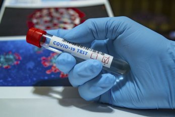 Azərbaycanda indiyədək 1536434 koronavirus testi aparılıb 
