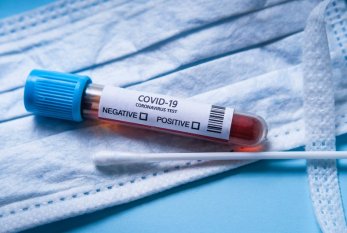 Azərbaycanda koronavirusa 4 077 yeni yoluxma qeydə alınıb, 43 nəfər vəfat edib 