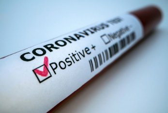 Azərbaycanda daha 1 052 nəfər koronavirusa yoluxub, 4 067 nəfər sağalıb 