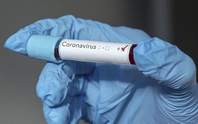 Azərbaycanda bir sutkada 799 nəfər koronavirusa yoluxdu, ölüm sayı azaldı
