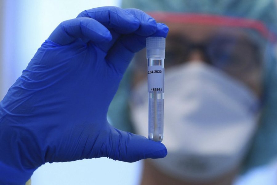 Azərbaycanda indiyədək 3 375 679 koronavirus testi APARILDI