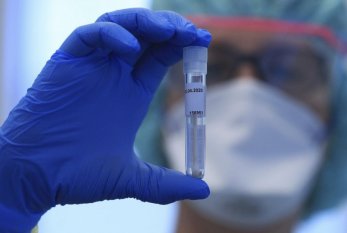 Azərbaycanda indiyədək 3 375 679 koronavirus testi APARILDI