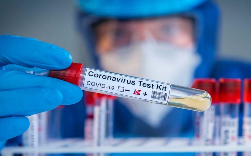 Azərbaycanda daha 174 nəfər koronavirusa yoluxdu 