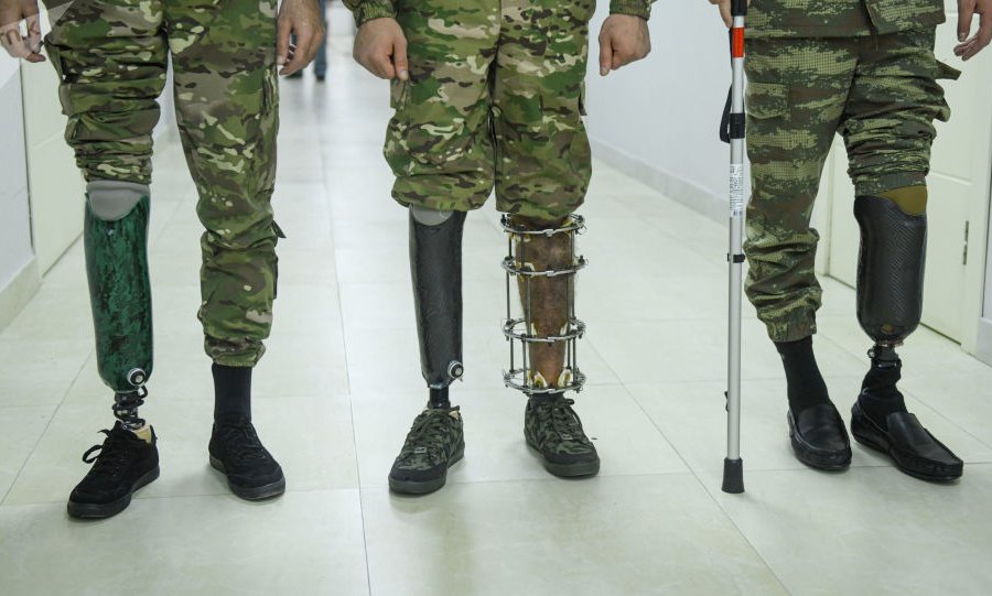109 qaziyə yüksək texnologiyalı protez verilib 