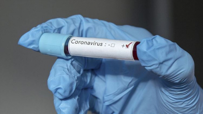 Azərbaycanda daha 668 nəfər koronavirusa yoluxdu 