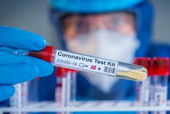 Azərbaycanda daha 174 nəfər koronavirusa yoluxdu 