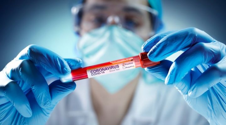 Azərbaycanda daha 37 nəfər koronavirusdan öldü 