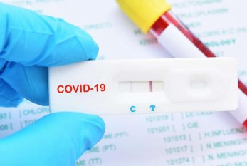 Azərbaycana giriş üçün COVID-19-a dair PCR testi tələbi ləğv olundu 